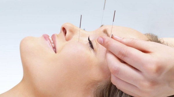 طب سوزنی و بیماری های روحی