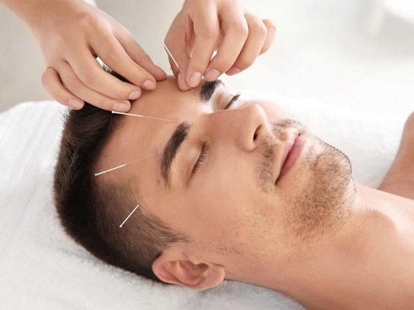 طب سوزنی و زیبایی